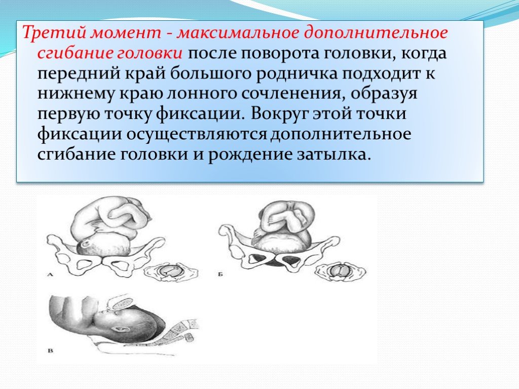 Передний вид затылочного. Биомеханизм родов точки фиксации. Биомеханизм родов при заднем виде затылочного предлежания. Биомеханизм родов при переднем виде затылочного предлежания. Точки фиксации при затылочном предлежании.