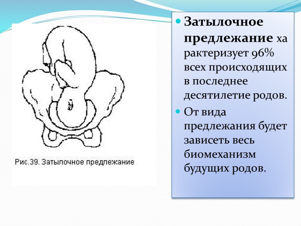 Заднее предлежание при родах. Затылочное предлежание. Затылочное предлежание плода. Затылочное предлежание биомеханизм. Роды в переднем виде затылочного предлежания.