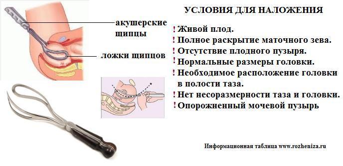 Презентация акушерские щипцы и вакуум экстракция плода