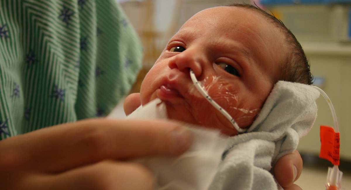 Новорожденный тяжело дышит. Зонд для недоношенных детей. Зондовое вскармливание недоношенного. Кормление деткй через зонт.