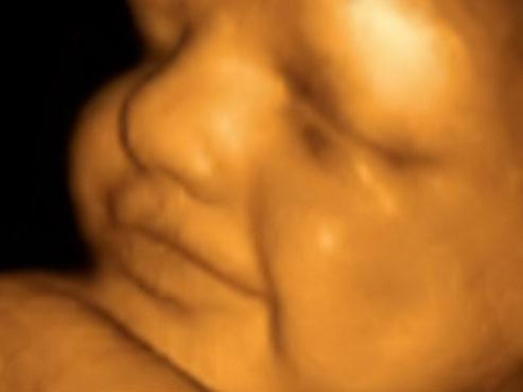 24 недели болит живот. 3д УЗИ на 24 неделе беременности. 23 Неделя беременности 3д УЗИ. Фото плода 24 недели беременности на УЗИ. Эмбрион 24 недели беременности.