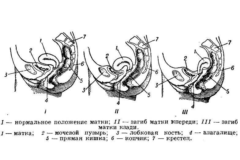 Строение органов малого таза у женщин схема после удаления матки