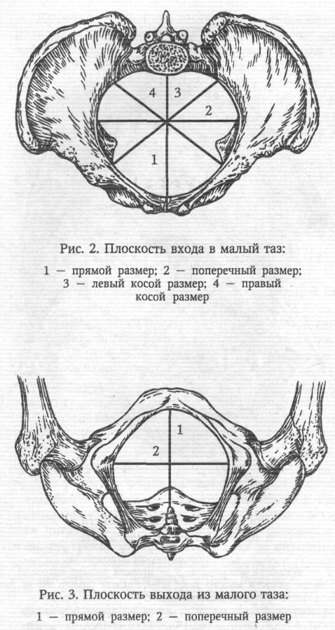 Акушерские размеры таза на рисунке