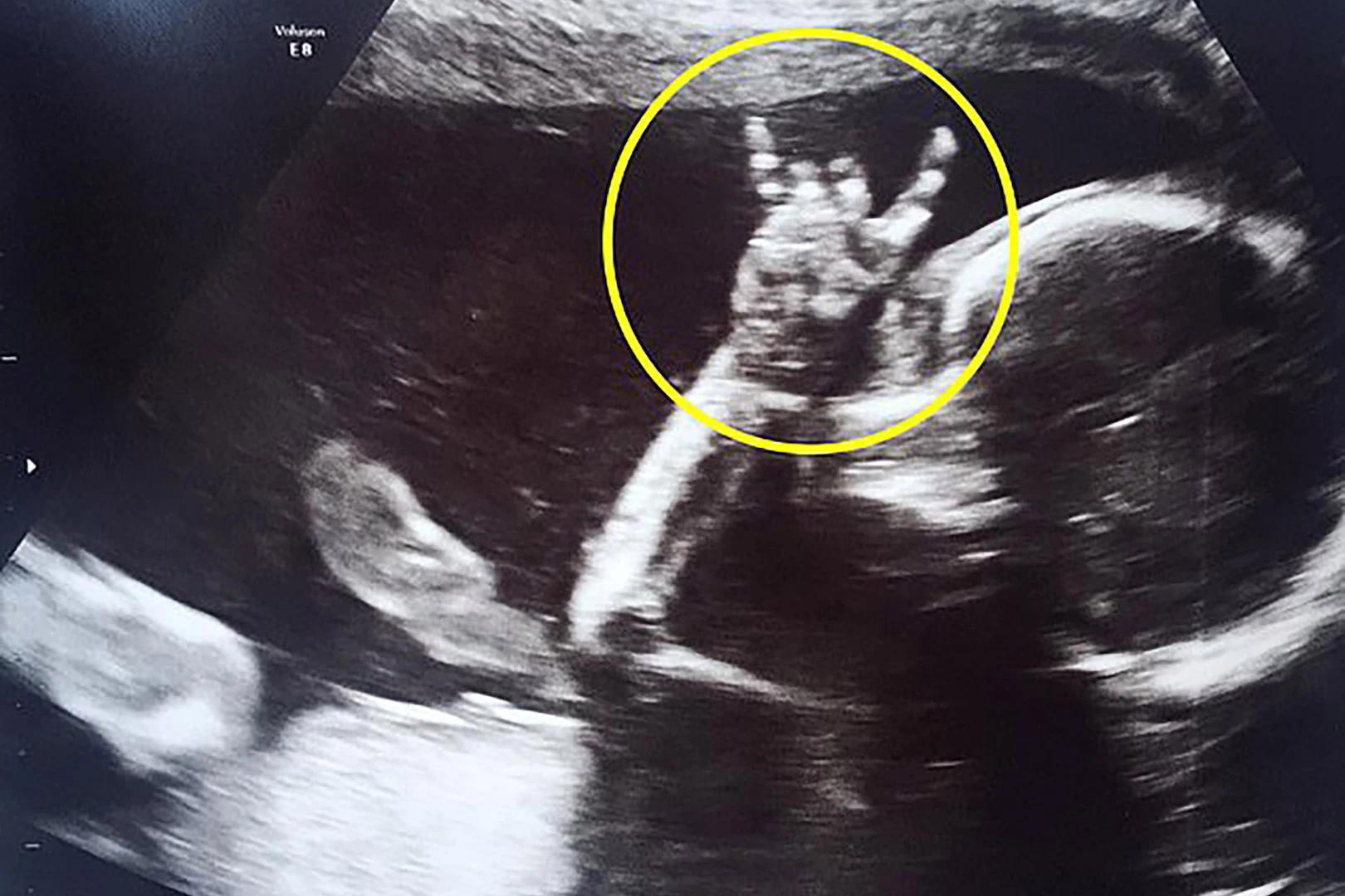 Фото в утробе в 20 недель беременности