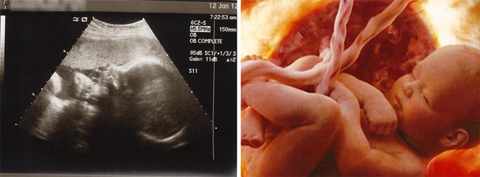 Как выглядит ребенок в 22 недели беременности фото плода