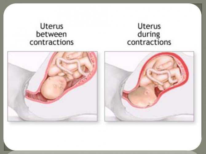 Повышенный тонус при беременности. Схваткообразный тонус матки. Тонус беременность. Тонус матки при беременности.