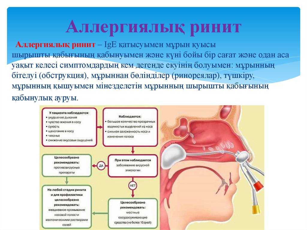 Острый ринит картинки