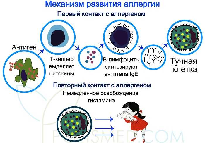 Аллергия контактам. Механизм развития аллергической реакции схема. Механизм возникновения аллергической реакции схема. Причины возникновения и механизм развития аллергических реакций. Механизм действия аллергической реакции.