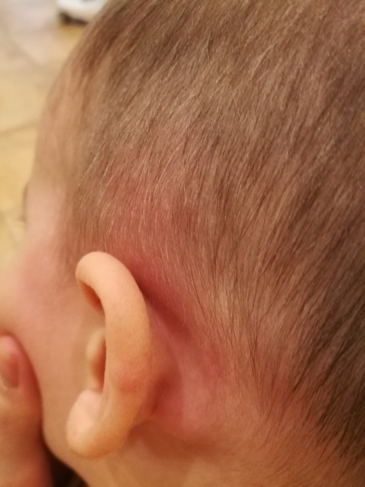 Как определить проблемы с ушками у младенца: Все о загибании ушей новорожденных