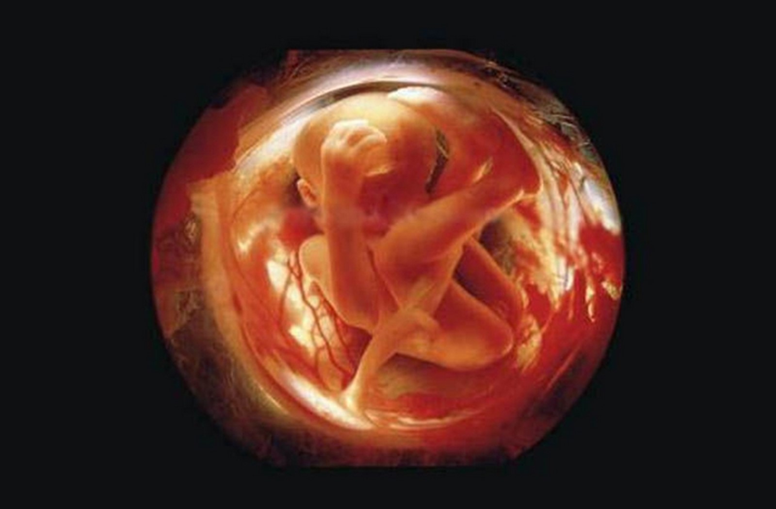 Шевеления на 19 неделе беременности. Эмбрион Леннарт Нильсон. "Зародыш, 18 недель", Леннарт Нильсон, 1965.. Леннарт Нильсон снимки в утробе. Леннарт Нильсон Зарождение.