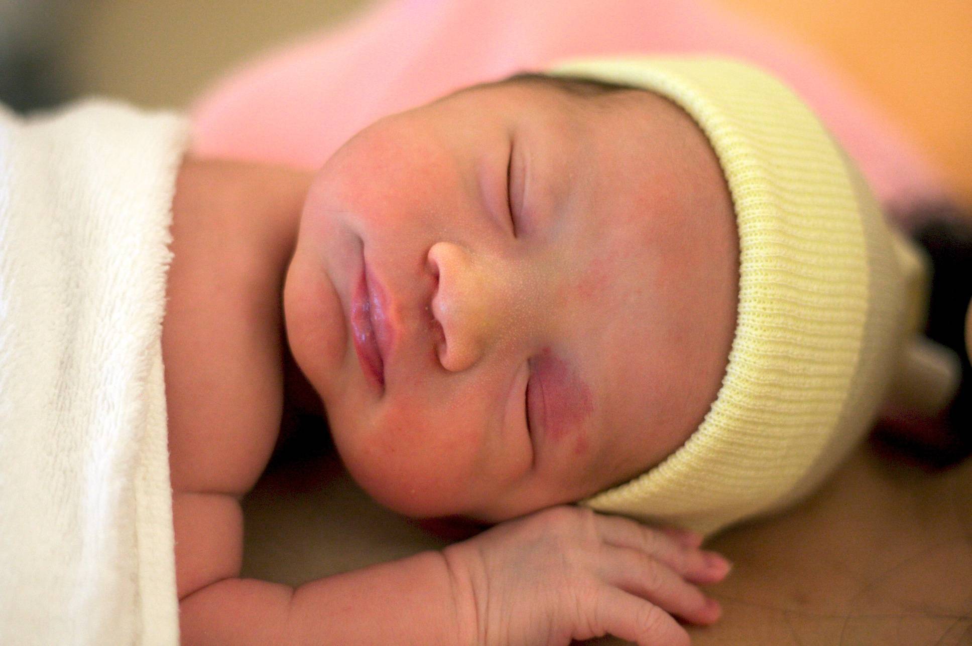 Физиологическая желтуха у новорожденных сколько. Желтушка у новорождённых. Родовая желтушка у новорожденных. Физиологическая желтушка у новорожденного. Желтушка у новорожденных 6.