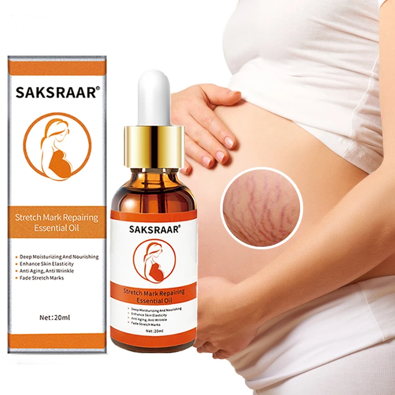 Как избавиться от растяжек при беременности: Секреты эффективного ухода за кожей живота
