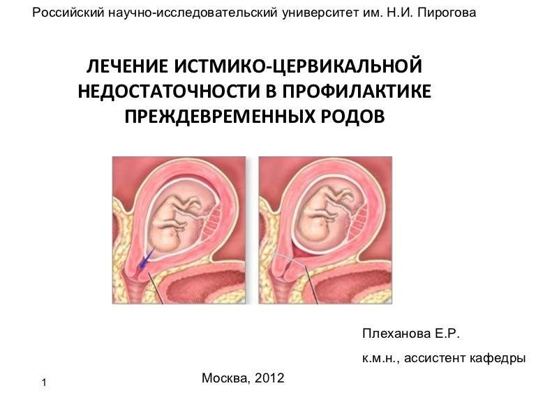 Беспокоит низкий ИЦН при беременности: Секреты комфортного вынашивания