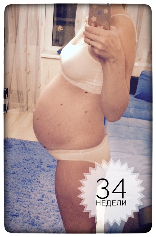 Беременность 35 недель болит низ. 34 Недели болит лобковая кость. Болит лобковая кость беременна 34 неделя. Беременность 35 недель полные женщины.