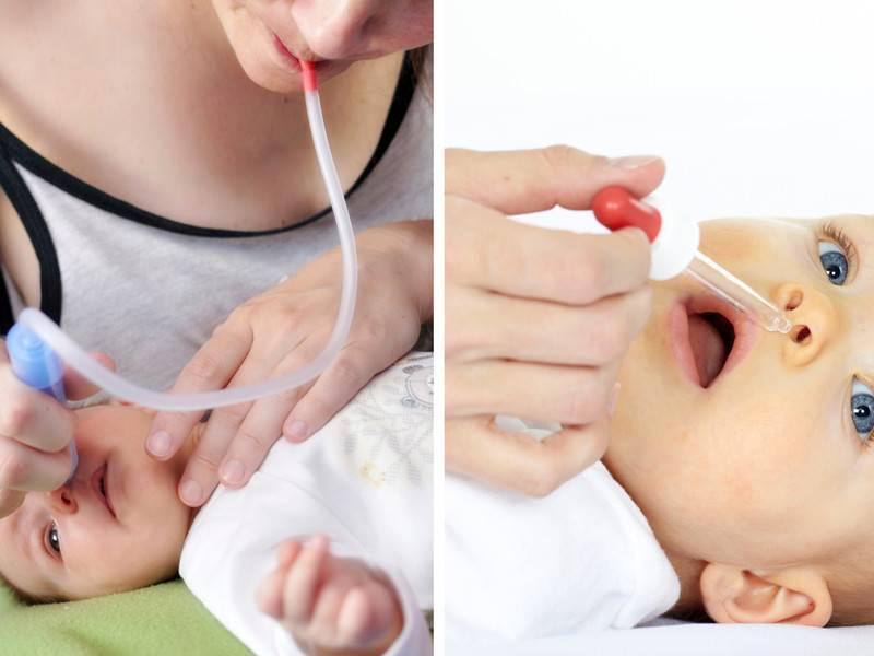 Как правильно очистить нос грудничка: Безопасные способы применения физраствора
