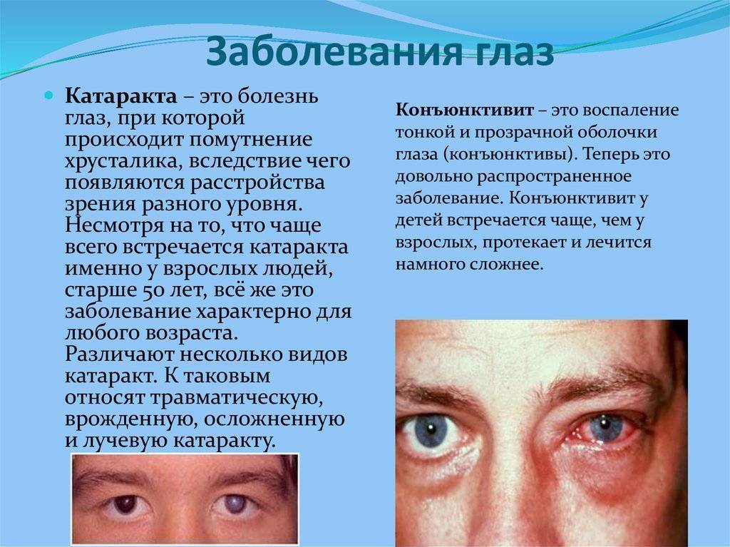 Отчего показать. Заболевания глаз список. Симптомы заболевания глаз.