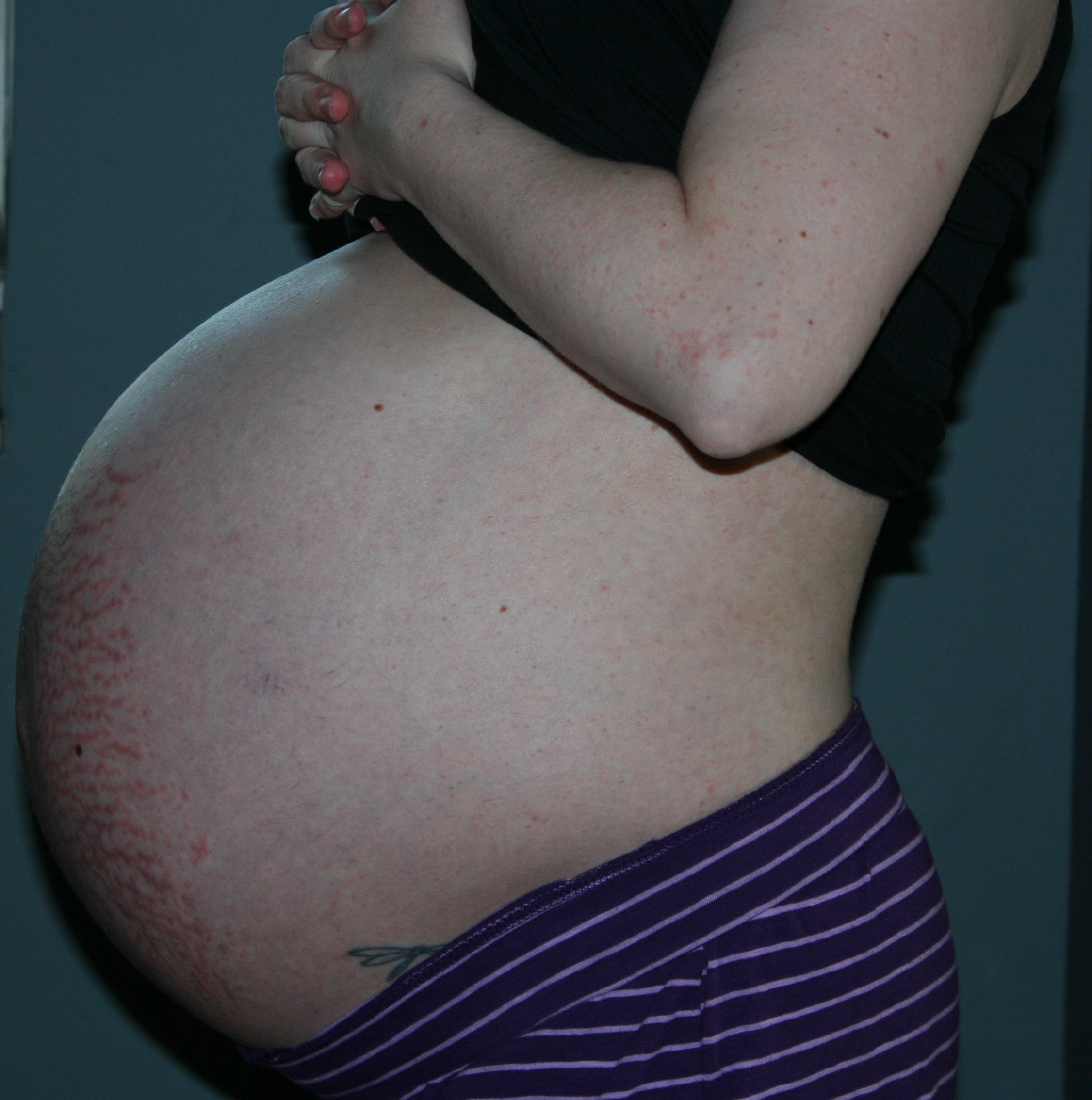 32 недели беременности сильно