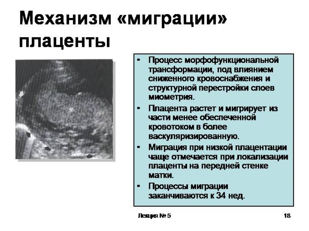 Что значит низкая плацентация при беременности