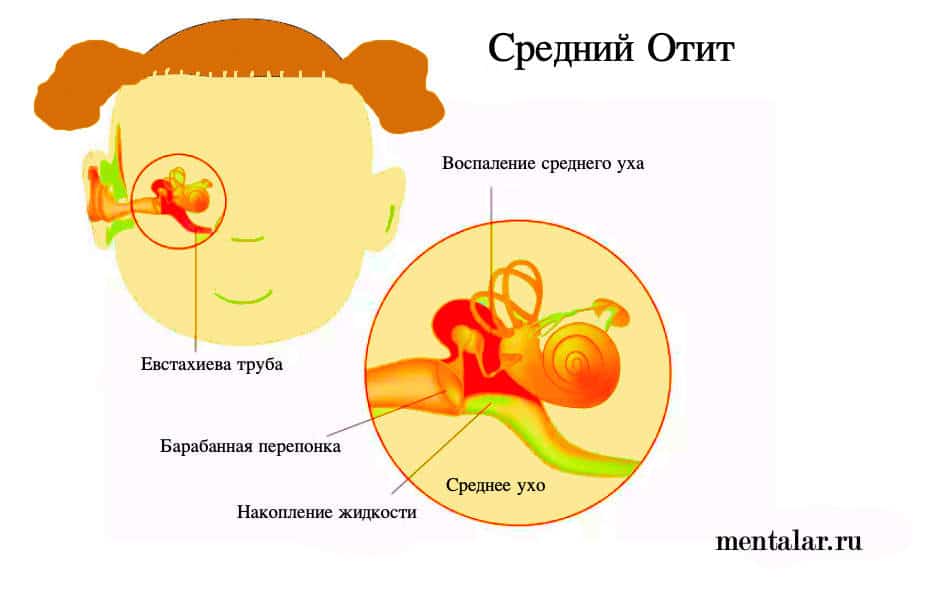 Как определить проблемы с ушками у младенца: Все о загибании ушей новорожденных