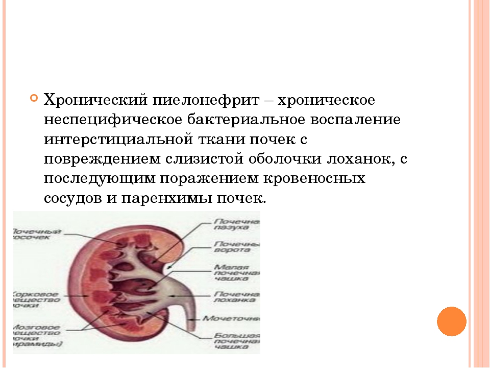 Воспаление почек пиелонефрит. Острый и хронический пиелонефрит. Бактериальное воспаление почечной ткани. Воспаление хронического пиелонефрита.