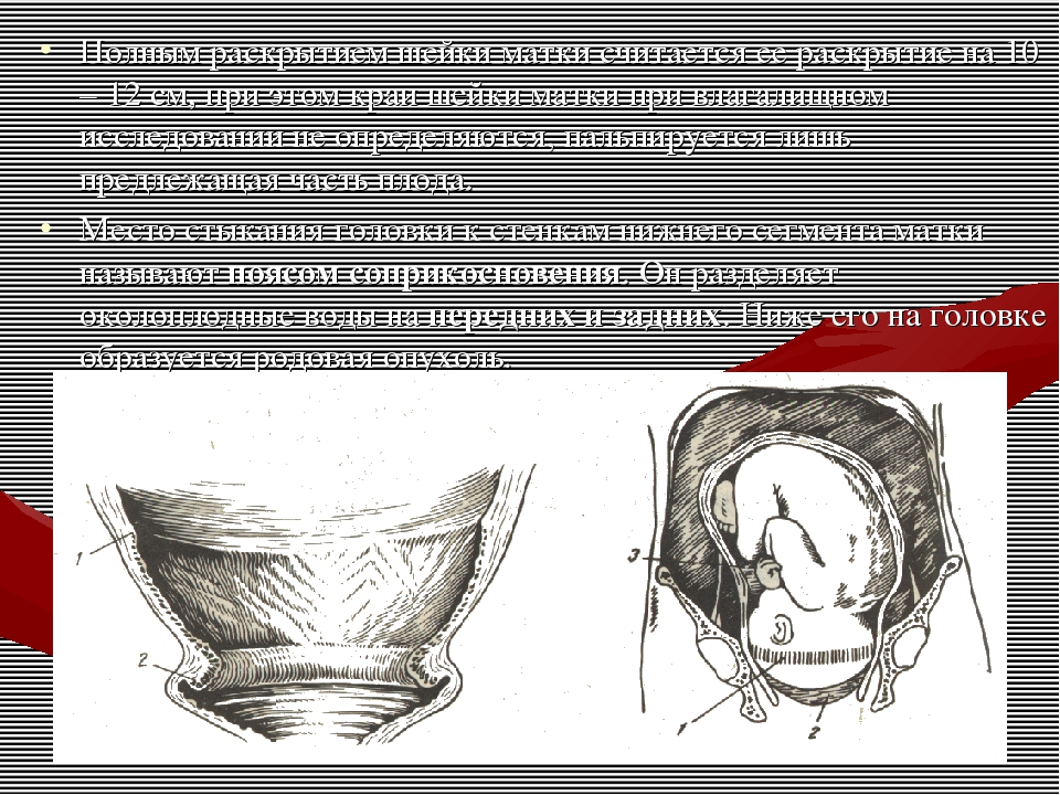 Раскрытие роли. Физиология шейки матки. Шейка матки физиология. Физиология раскрытия шейки. Послеродовый шов на шейке матки.