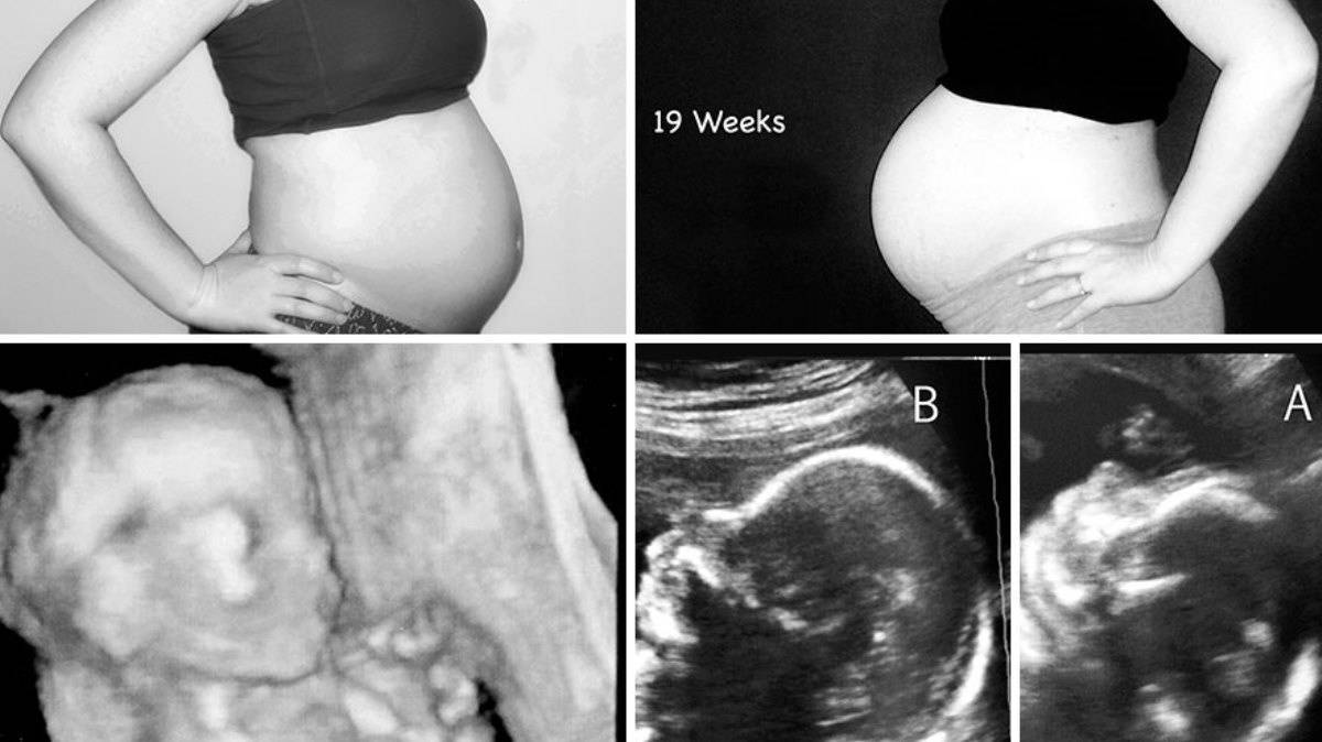 32 неделя беременности что происходит с мамой