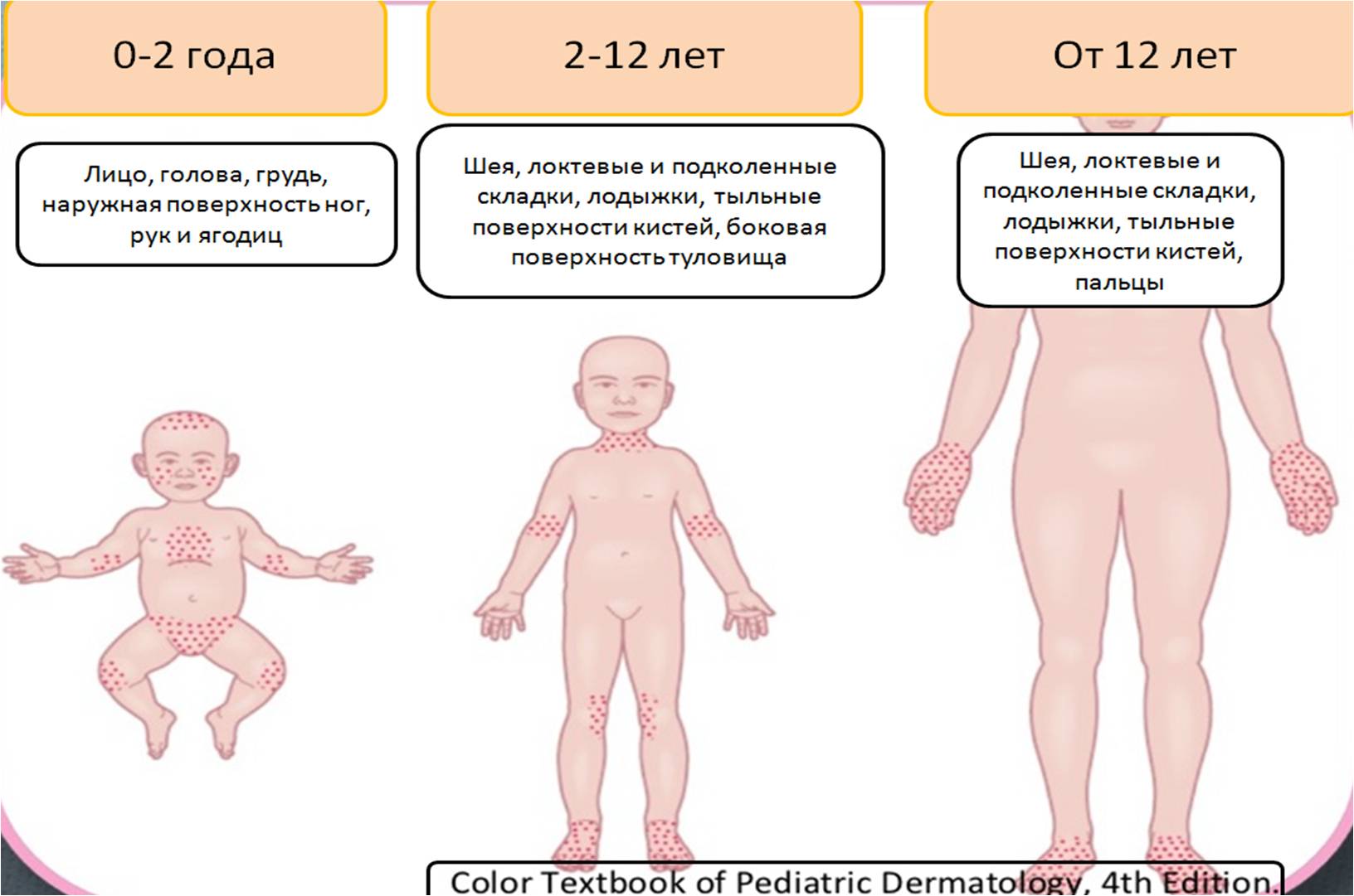 голова больше груди 6 месяцев фото 116