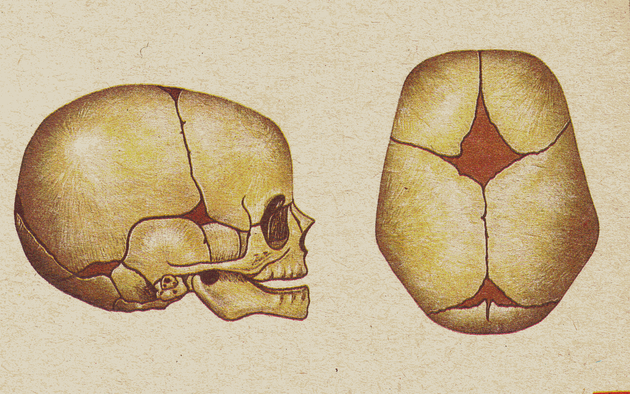 Швы большого родничка. Кости черепа новорожденного роднички. Роднички новорожденного анатомия черепа. Строение черепа новорожденного швы роднички. Роднички черепа у новорожденных анатомия.
