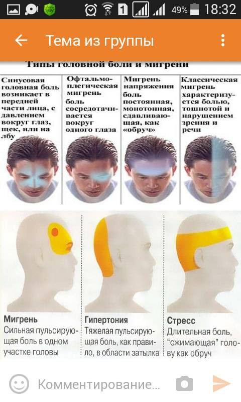 Почему голова болит в висках и глаза. Схема локализации головной боли. Причины головной боли. Болит затылок головы.