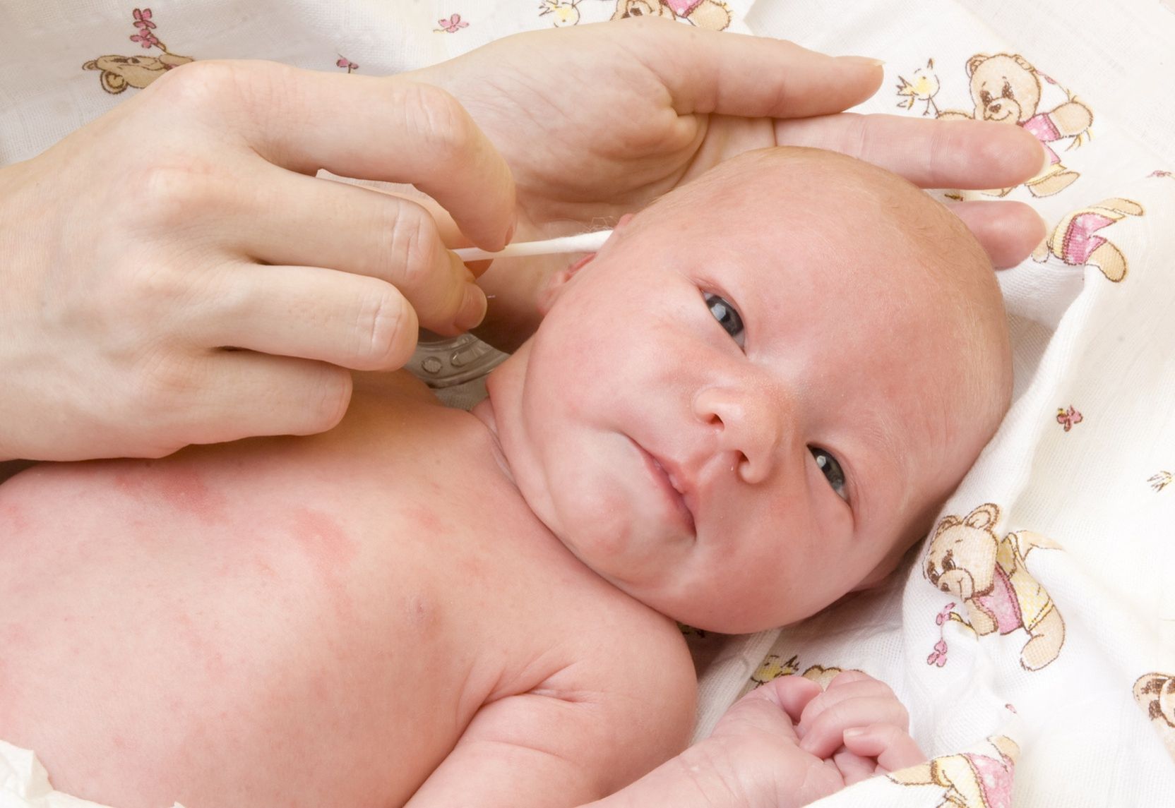 Как определить проблемы с ушками у младенца: Все о загибании ушей новорожденных