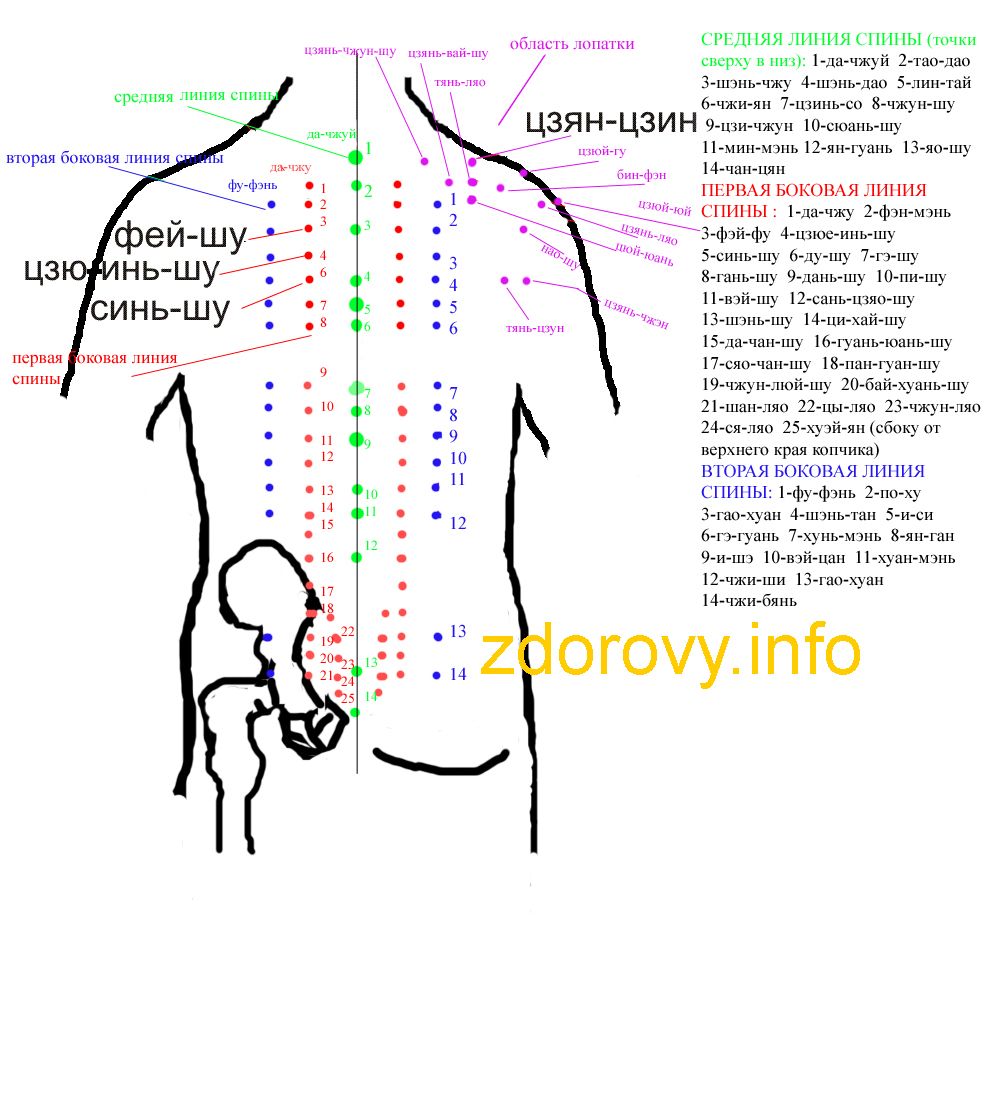 Банки при болях в пояснице схема