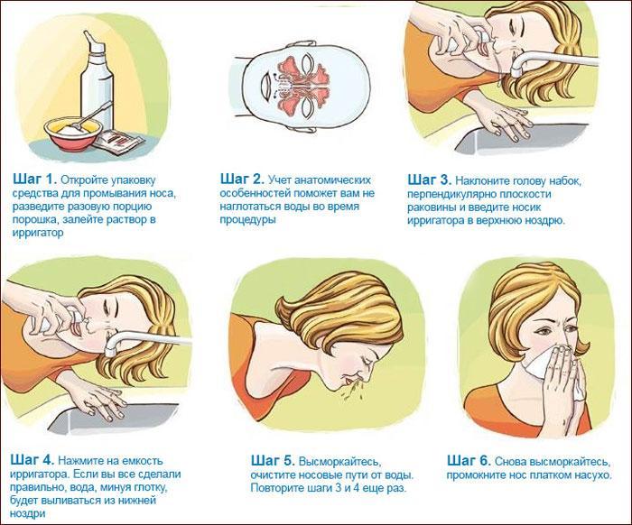 Что делать если нос забит соплями. Как быстро вылечить насморк. Как быстро вылечить насморк у взрослого.