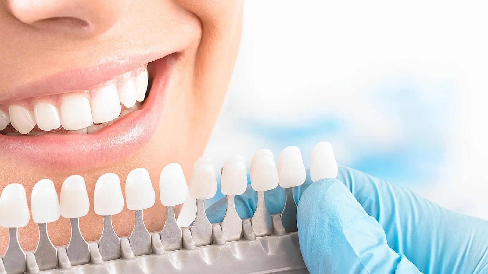 Красивые зубы. Отбеливание зубов. Красивые зубы стоматология.