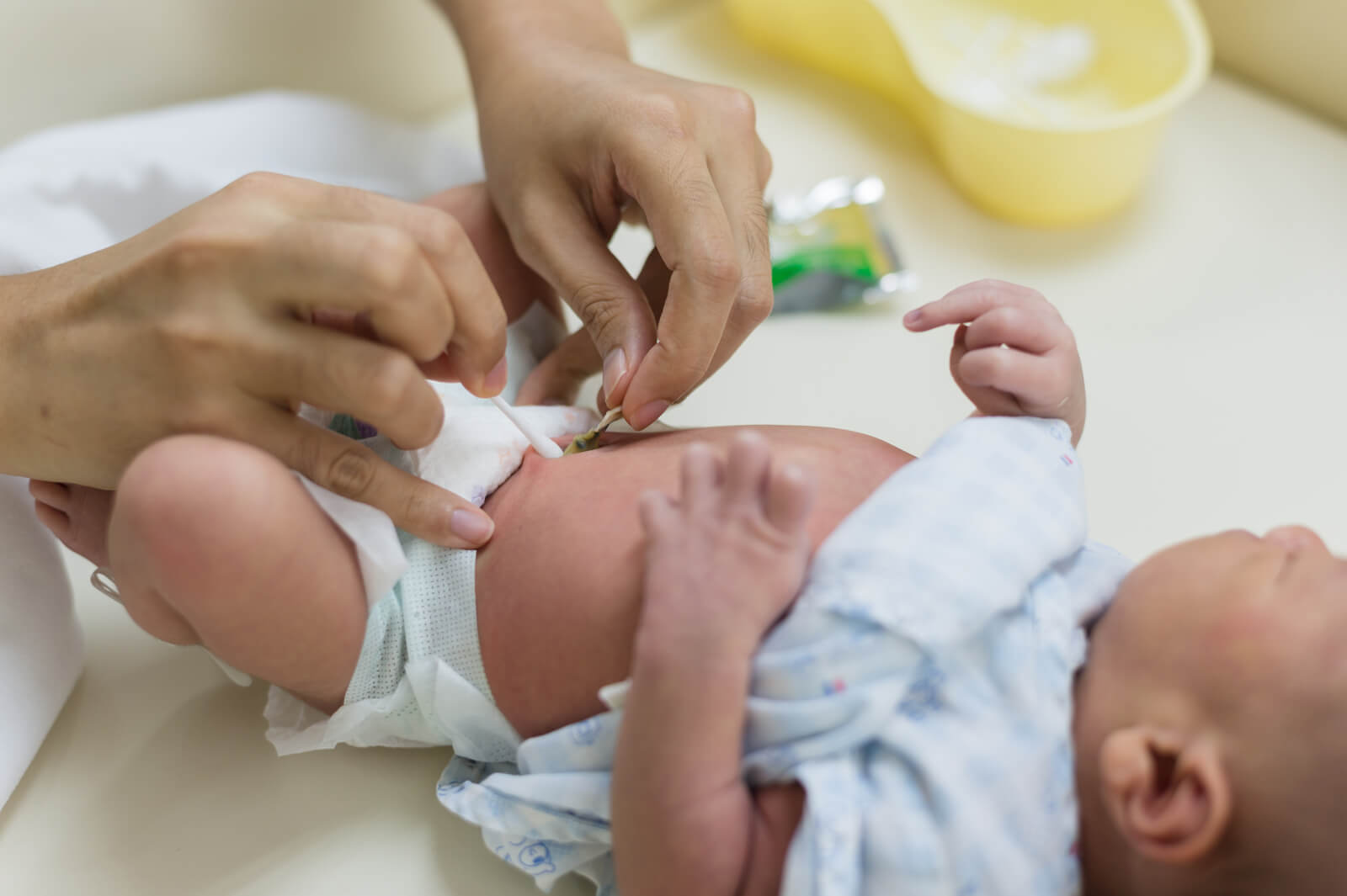 Как лечить мокнущий пупок у новорожденного: Советы заботливым родителям