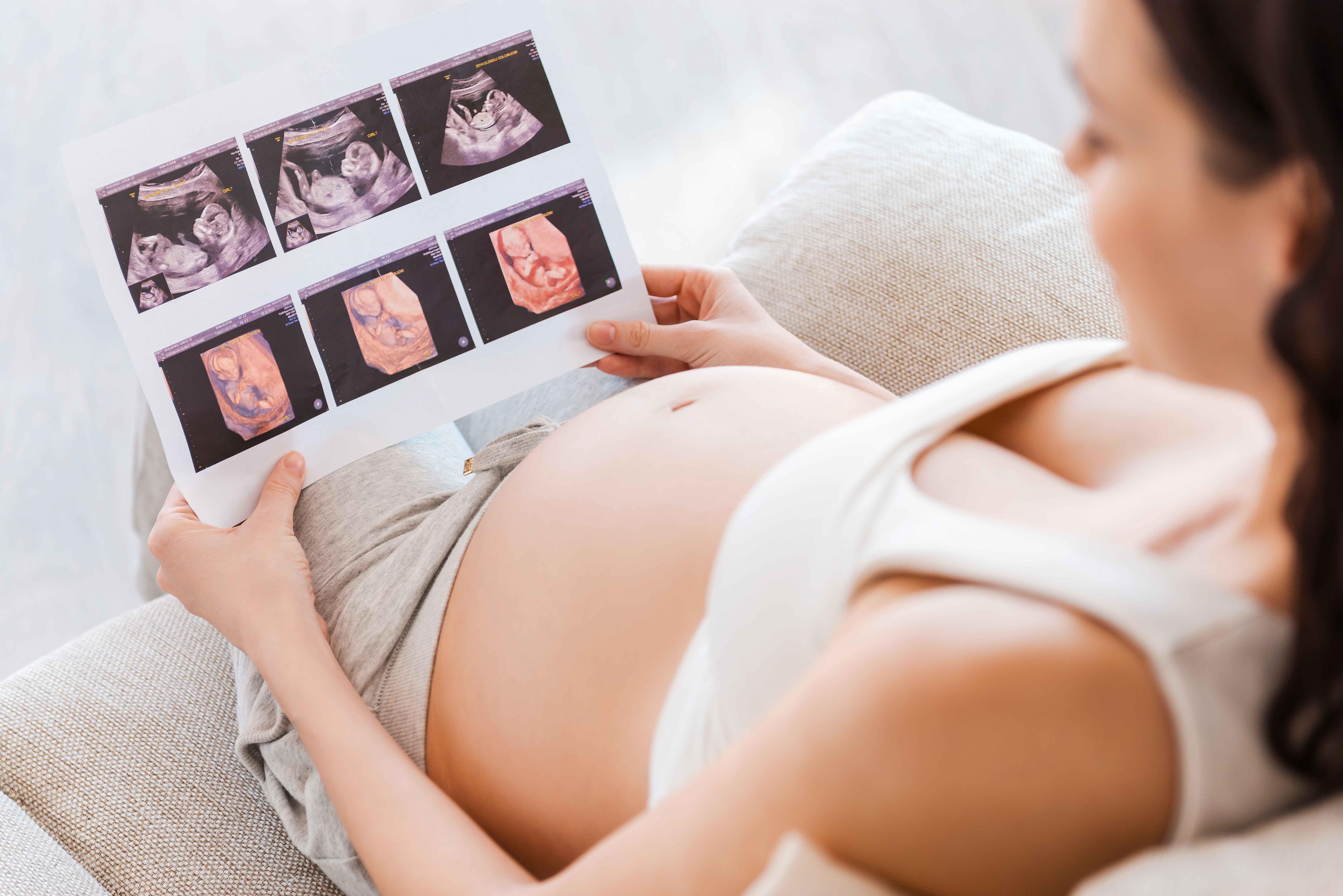 Как проходит 17 неделя беременности: Ощущения и опыт будущих мам