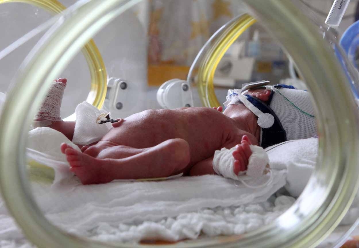 Недели ребенок жизнеспособен. Выхаживание новорожденных. Недоношенный новорожденный. Выхаживание недоношенных детей.