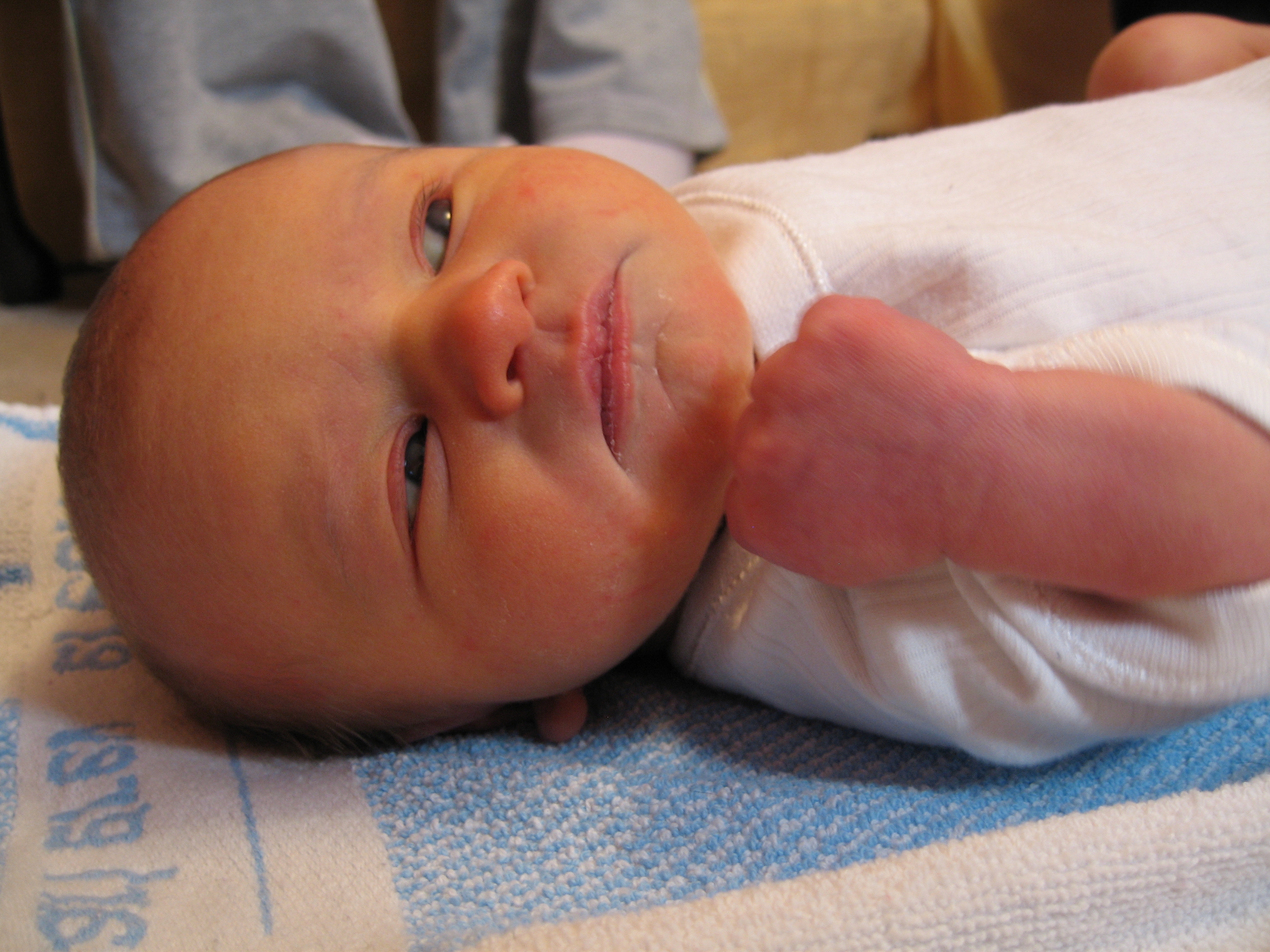 Ребенку 2 недели плачет. Желтушка у новорожденных. Что такое желтушка у новорожденных детей. Неонатальная желтуха физиологическая. Физиологическая желтушка у новорожденного.