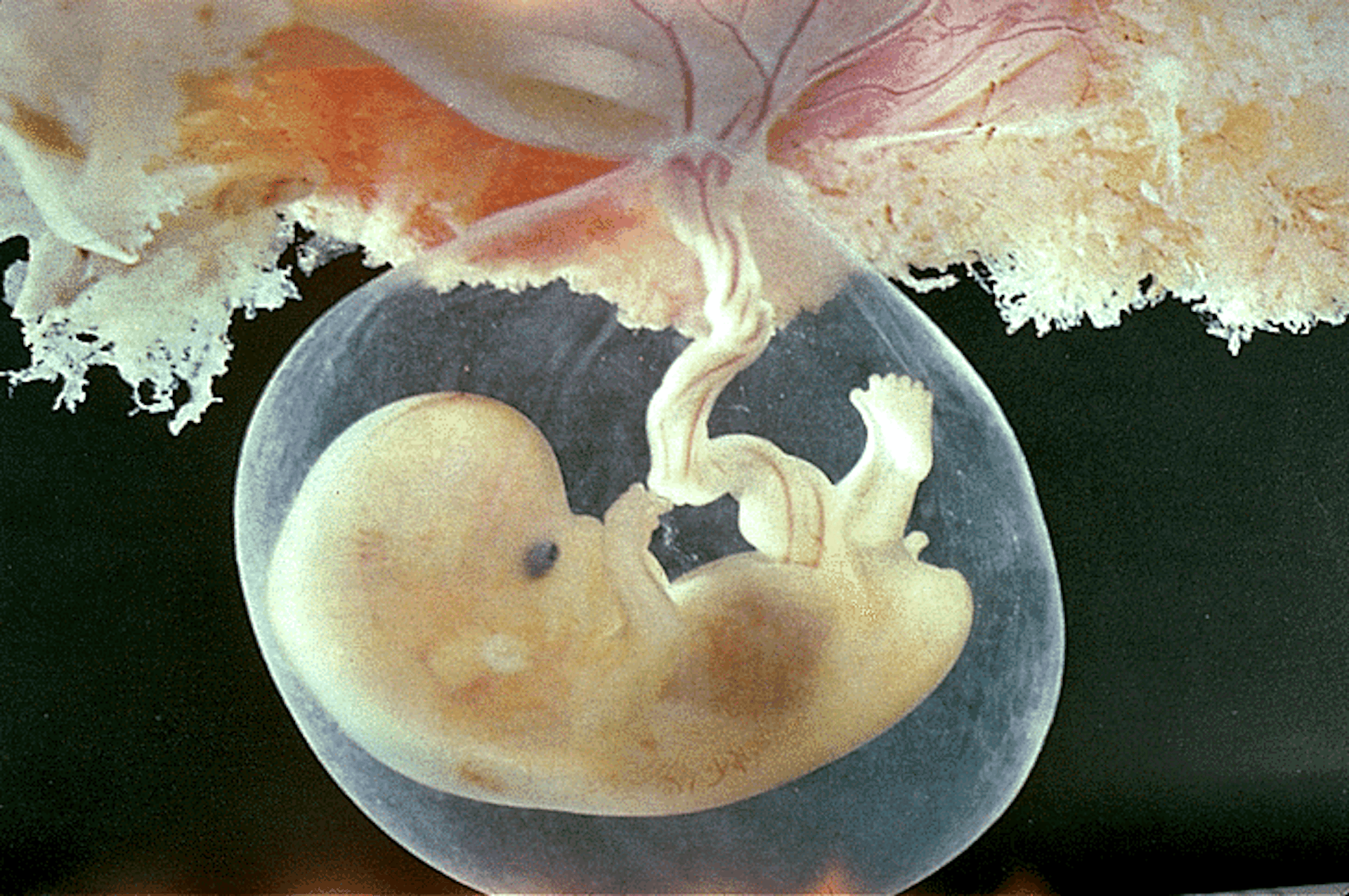 6 недель изменения. Зародыш 6-7 недель беременности. Зародыш человека 9-10 недель. Плод на 6 неделе беременности. Эмбрион на 7 неделе беременности.