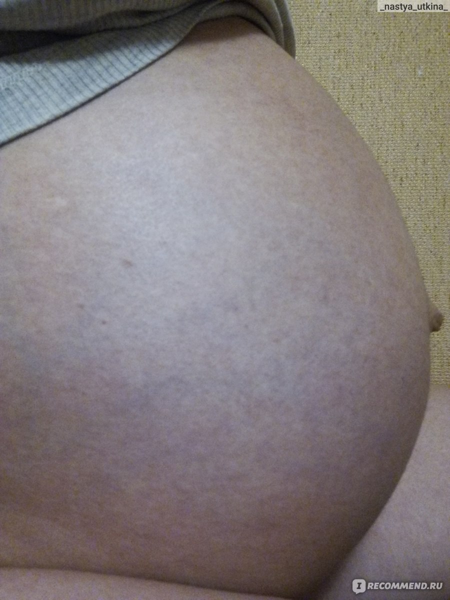 Как предотвратить растяжки вокруг пупка при беременности: Секреты красивого животика