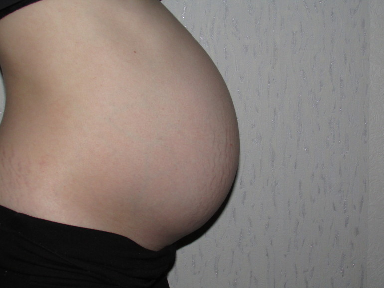 35-36 Недель беременности. Беременность 36 недель болят. 36 Недель беременности болит спина.