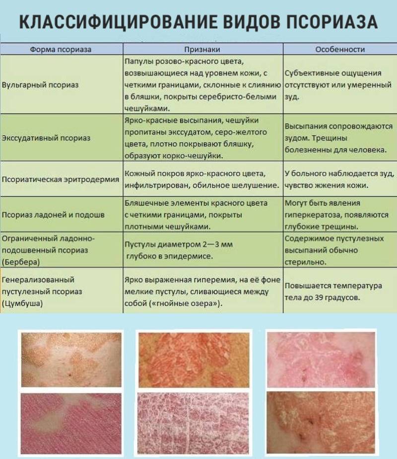 Как лечить атопический дерматит летом: Солнечные секреты здоровой кожи