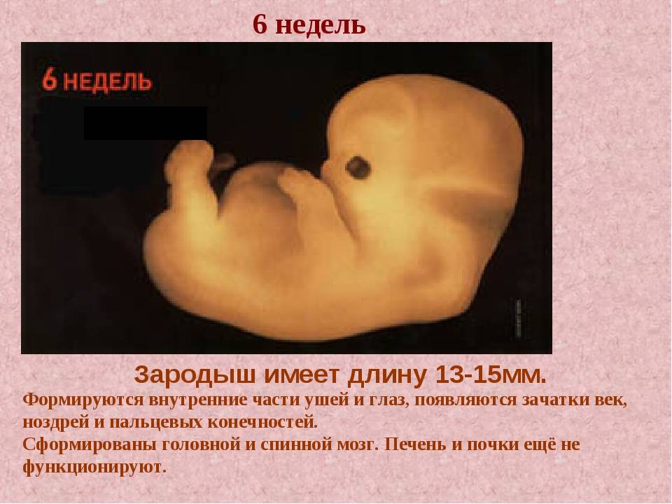 Недельный период. Размер эмбриона на 6 неделе. Зародыш 6 недель размер.