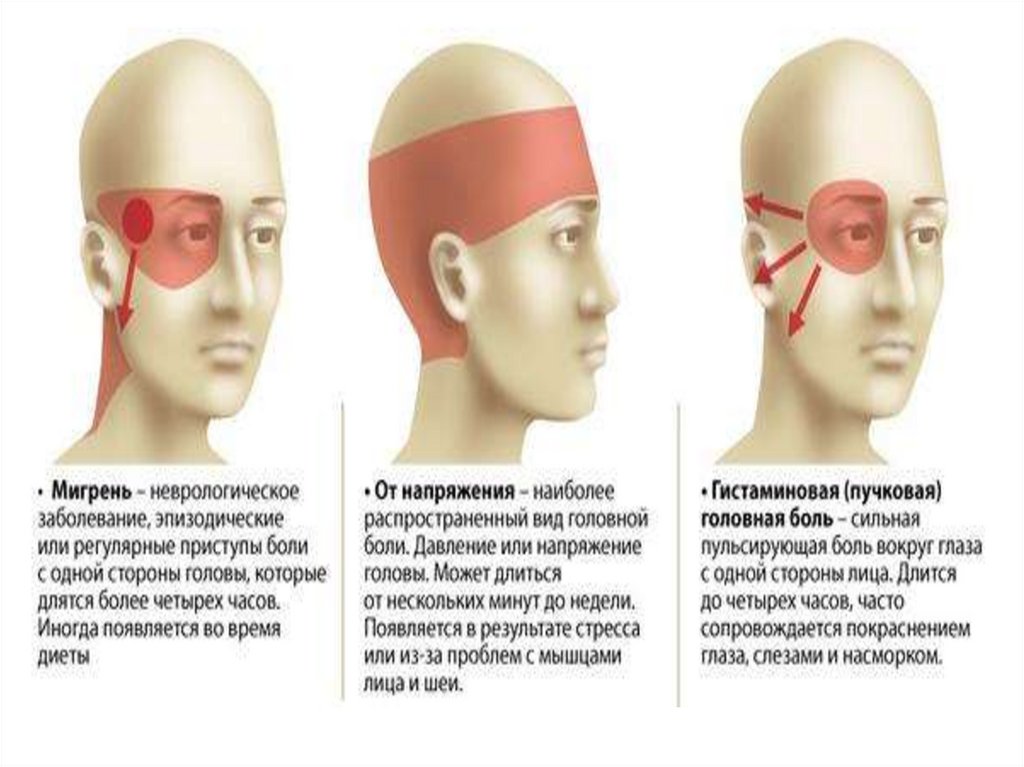 Типы головной боли. Пульсирующая головная боль в лобной части. Боль в висках головы.