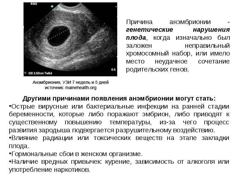 Как диагностировать беременность на ранних сроках: Что нужно знать о плодном яйце