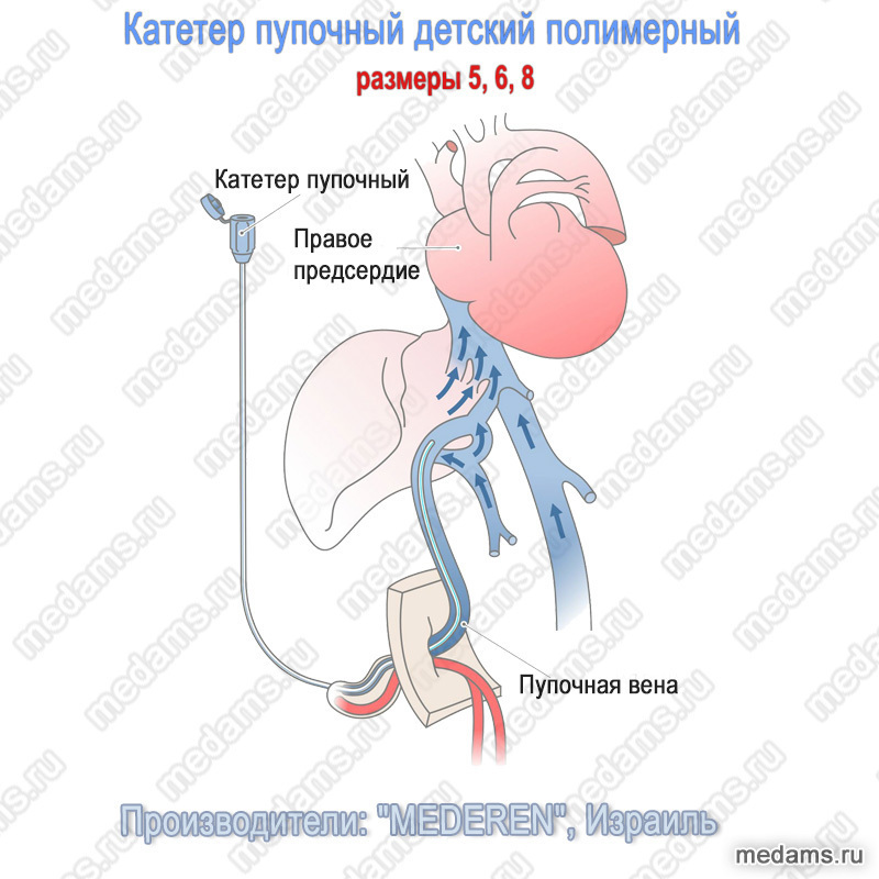 Как кровь из пуповины спасает жизни: Секреты будущего медицины