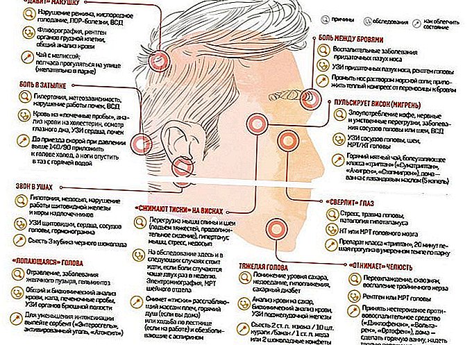 Картинки головная боль где болит