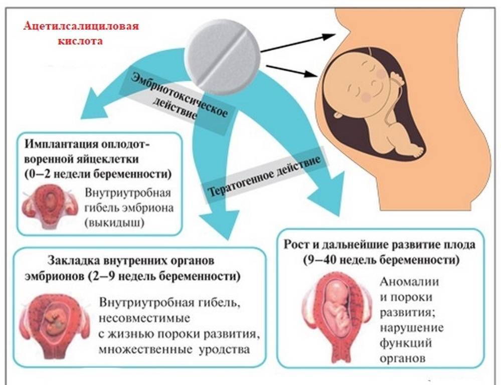 Беременность на 10 неделе без симптомов: что это значит и стоит ли беспокоиться