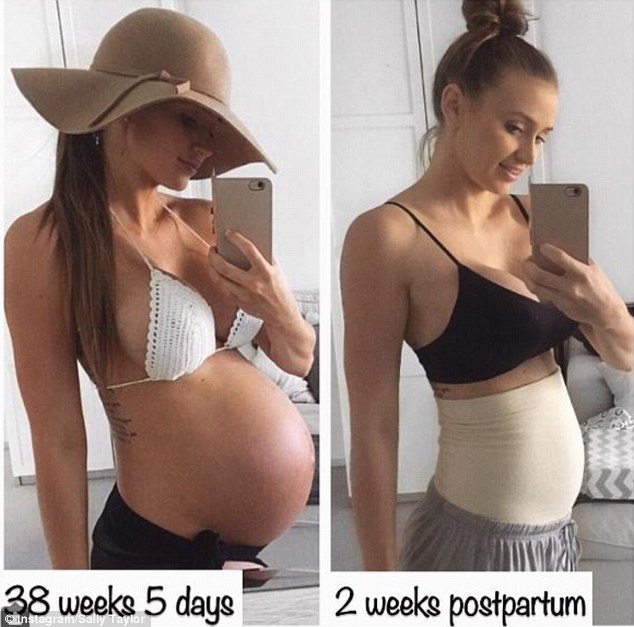 Живот через месяц после родов. Живот до и после беременности. Живот после рождения ребенка.