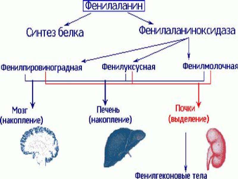 Фенилкетонурия клиническая картина