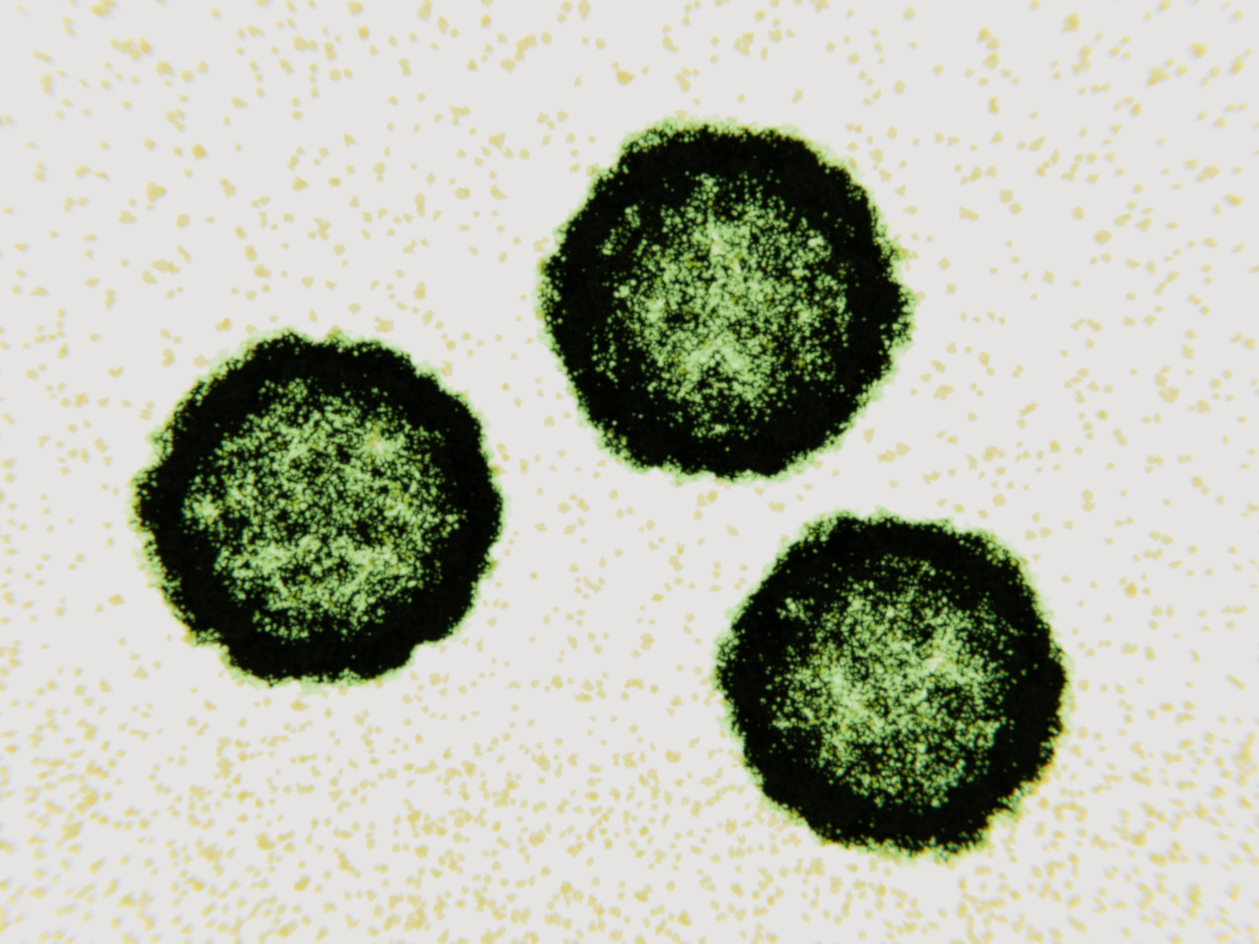 Взрослый вирус. Coxsackievirus b3. Астровирусы микробиология. Вирус Коксаки микроскоп. Возбудитель астровирусы.